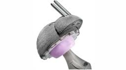 Revisão de Prótese de Quadril